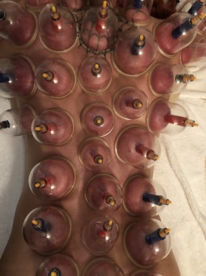 BS__6242438