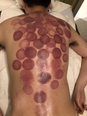 S__11632644