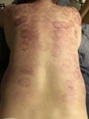 S__11632674