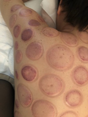 S__11632740