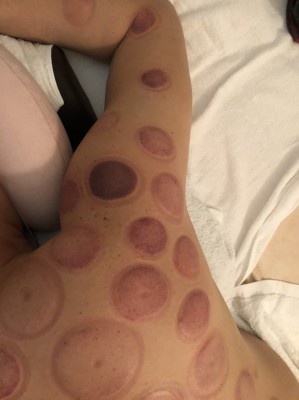 S__11632741